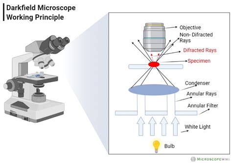 Dark Field Microscopy: Unlocking Hidden Cellular Secrets