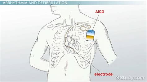 NKDA Medical: Uncover Its Meaning Simply